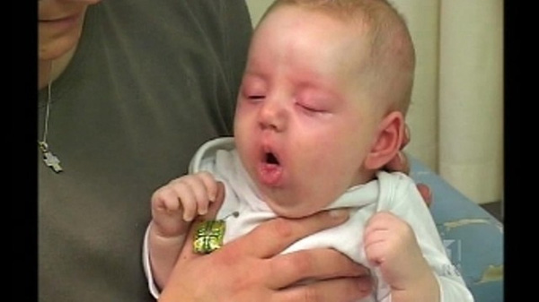 Trẻ sơ sinh bị ho dấu hiệu của bệnh viêm phổi có thể nguy hiểm đến tính mạng