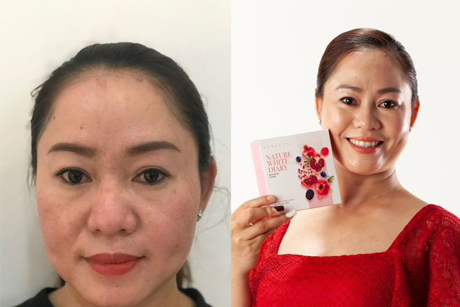 Viên uống trắng da Hanvely giá bao nhiêu, mua ở đâu bảo đảm nhất? nguoi su dung - Viên uống trắng da Hanvely giá bao nhiêu, mua ở đâu bảo đảm nhất?